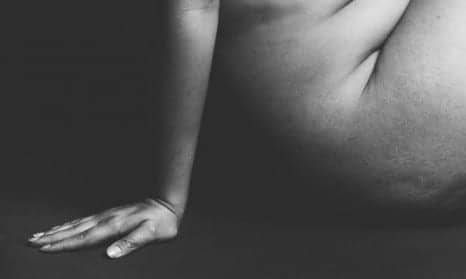 Black Women Are Underrepresented In The Breast Cancer Community, Even Though They're More Likely To Die From The Disease