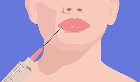 Everything You’ve Ever Wanted to Know About Fillers