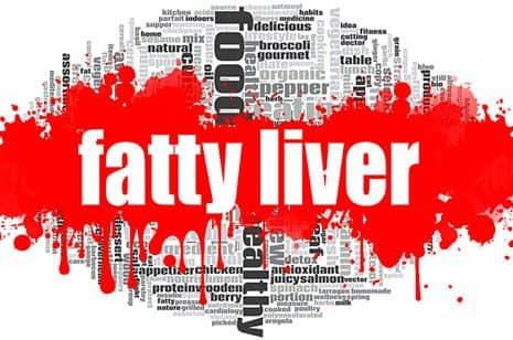 Study Links Severity of Psoriasis, Non-Alcoholic Fatty Liver Disease