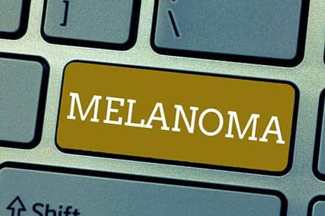 Combining Three Treatment Strategies May Significantly Improve Melanoma Treatment