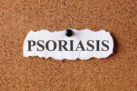 Don't Ignore Sleep Problems in Psoriasis Patients