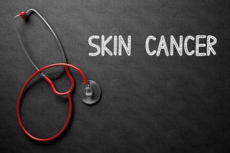 Skin Cancer Cells Use Pathway to Sidestep the Immune System, Per Study