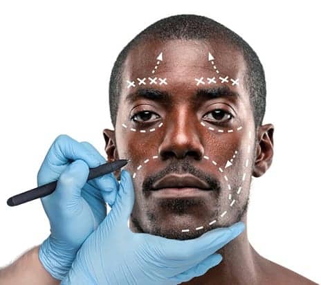 Race Influences Our Response to Cosmetic Surgery