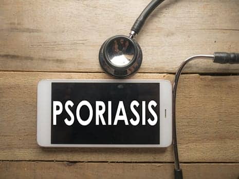 US Latinos Disproportionately Affected by Psoriatic Disease Severity