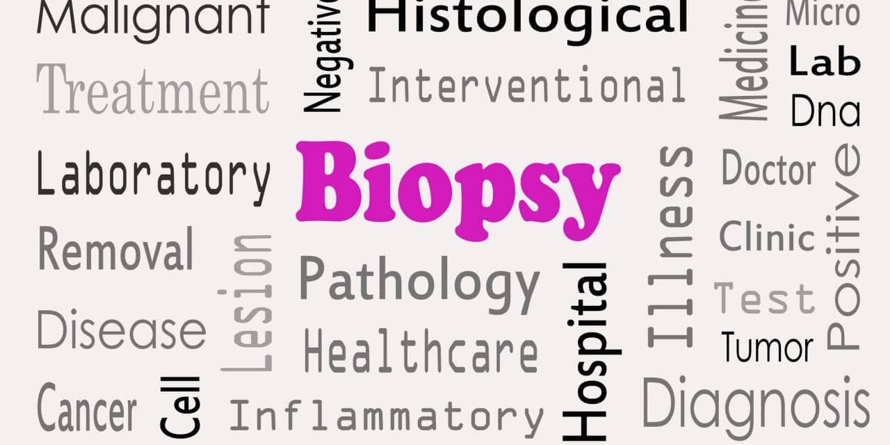 Dermatologists Perform Fewest Biopsies to Diagnose Skin Cancer