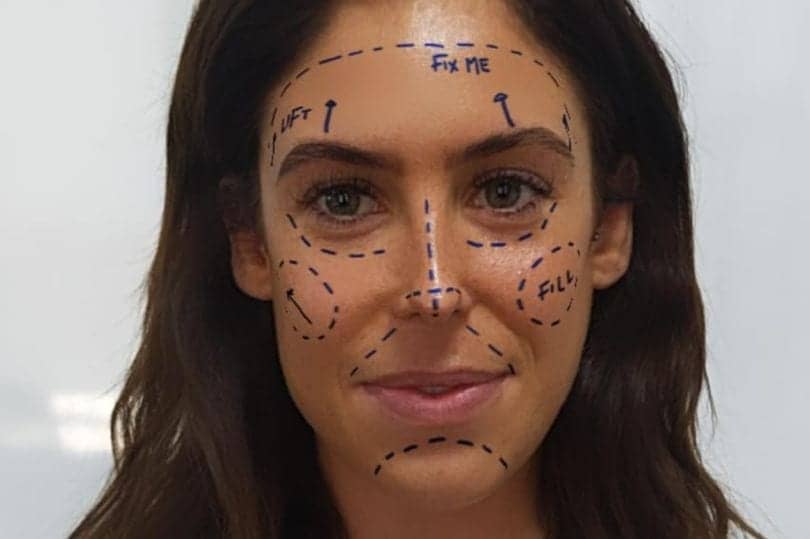 Instagram ‘Fueling Mental Health Crisis’ with “Fix Me” Plastic Surgery Filter