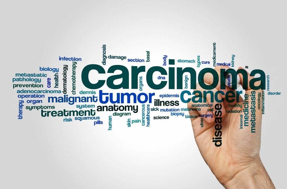 Expert: Dermatologists Should Take Lead on Cutaneous SCC