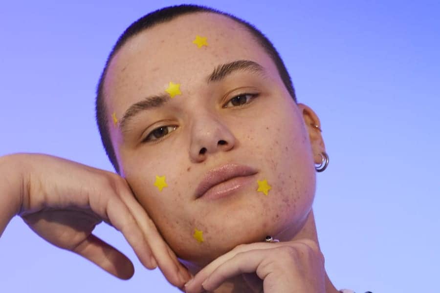 Pimple Patches Are Everywhere, But Do They Work?