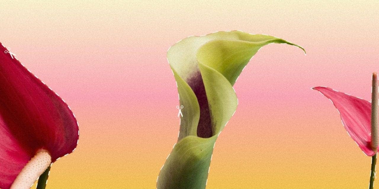 The Rise Of The Designer Vagina