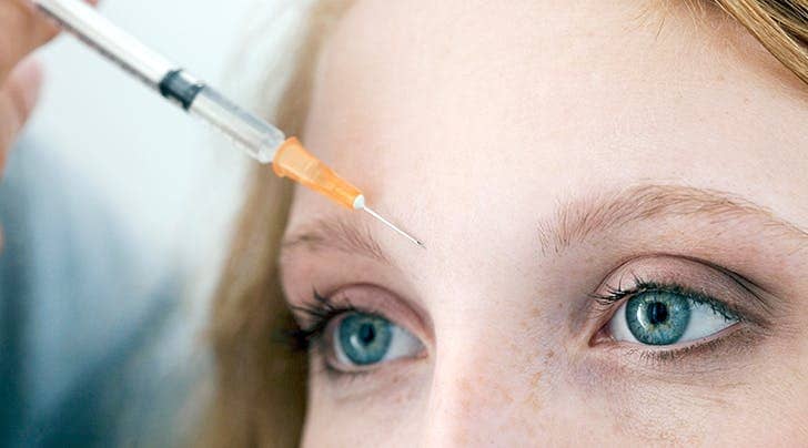 Are Smooth Threads the Next Botox? Here’s What You Need to Know About the Trending Treatment