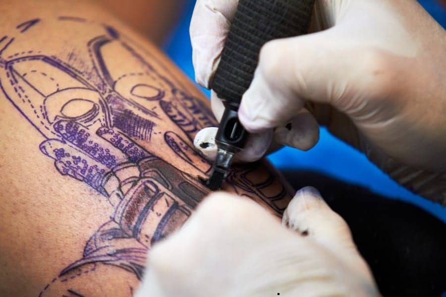 Tattoo Removal Company Seeks to Ride a Wave of Millennial ‘Regretters’
