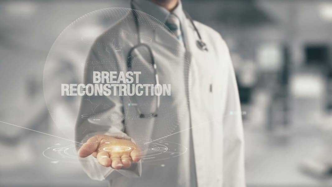 Identifying the Best Approach to Single Breast Reconstruction with UTSW