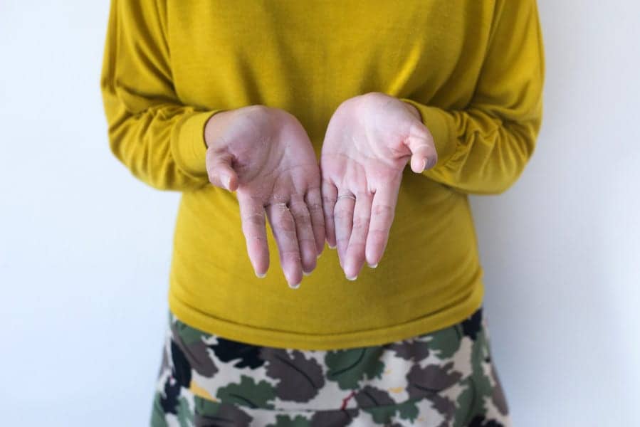 Why Your Hands May Be Peeling This Winter, According to Dermatologists