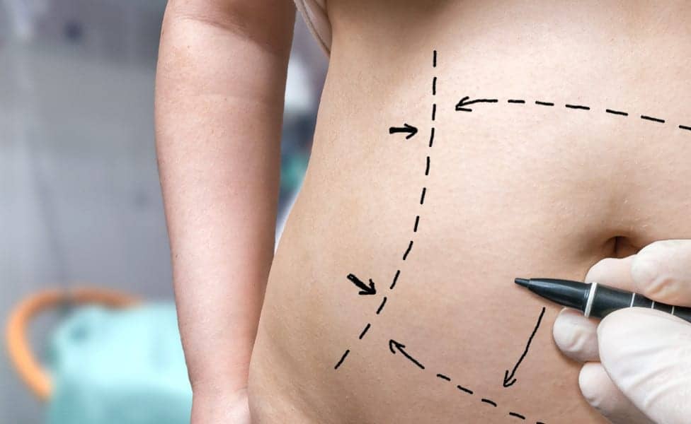 A Mom’s Guide to Plastic Surgery