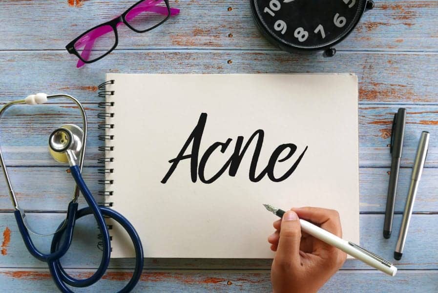 Signs Your Hormones Might Be To Blame for Your Adult Acne