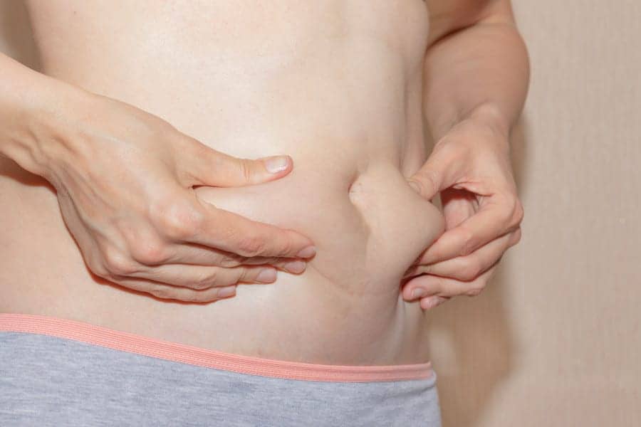 What Not to Do After Liposuction During the First Week and Beyond