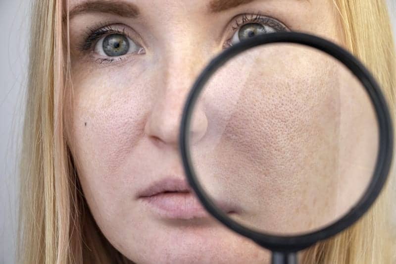 Exactly How to Unclog Pores, According to Skincare Experts