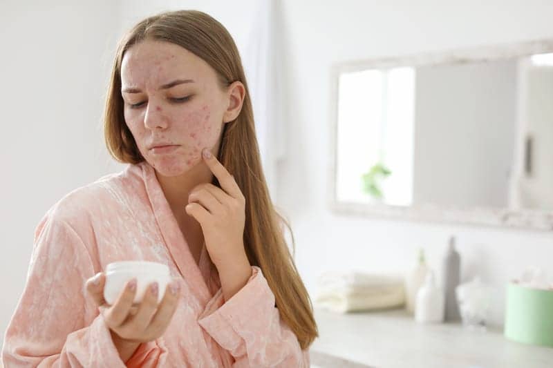Do You Have ‘Isolation Skin’?
