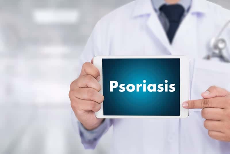 First-Ever Guidelines for Pediatric Psoriasis Bring Unique Concerns to Forefront