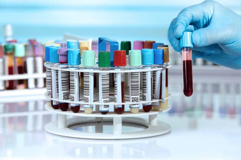This Common Protein Could Be the Secret To a Much Longer, Healthier Life