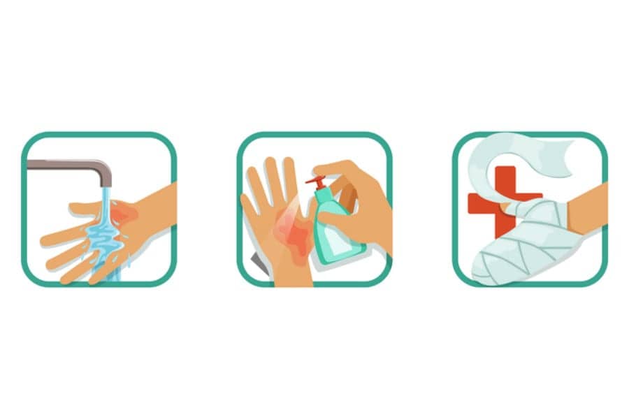The Right Way to Treat Burns, According to Dermatologists