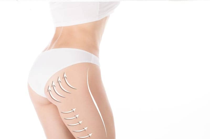 5 Things Reputable Plastic Surgeons Say Should Never Happen with Butt Augmentation