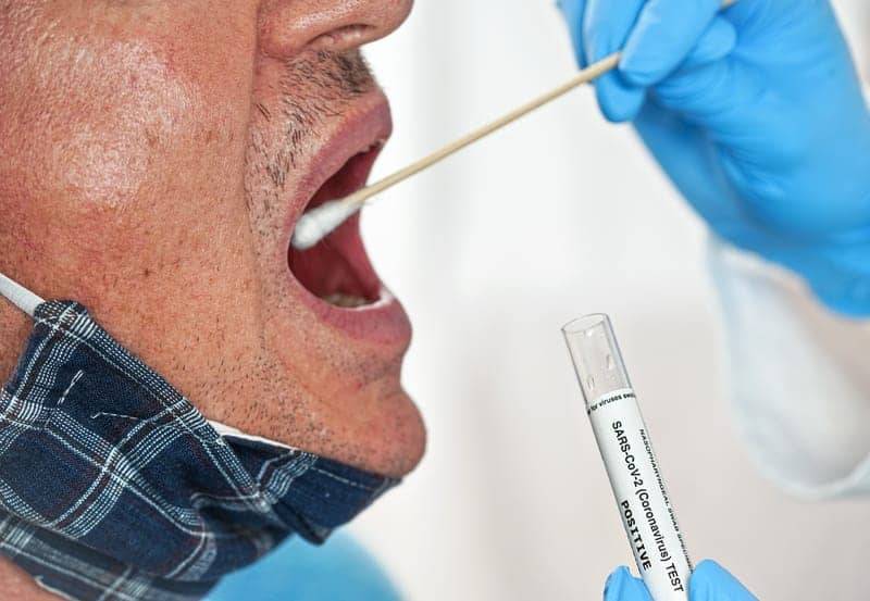Another COVID-19 Symptom Joins the List: Mouth Rash