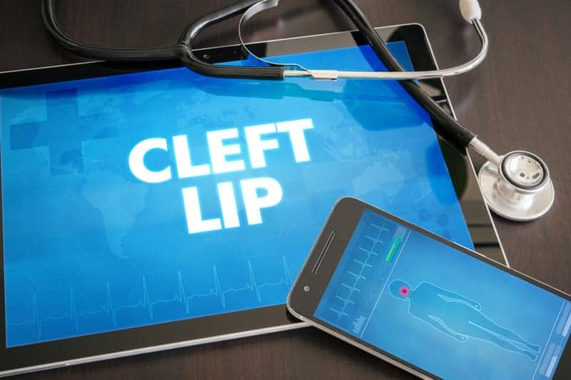More Cleft Lip Surgeries at Age 8 to 10 Years Tied to Later Anxiety