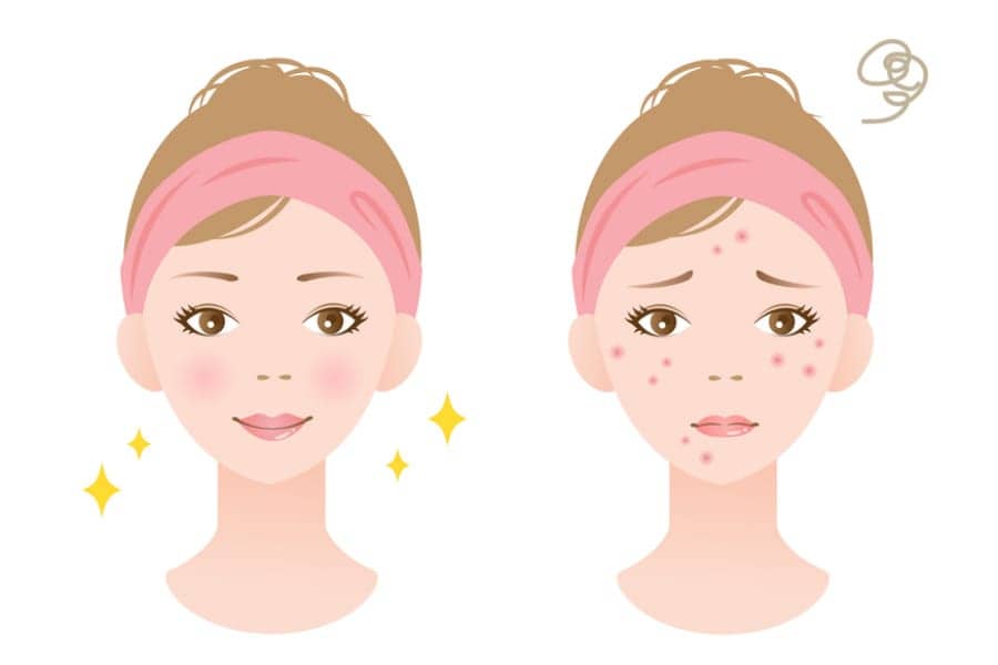 Lifestyle, Age, and Sex Affect Several Biophysical Properties of the Skin