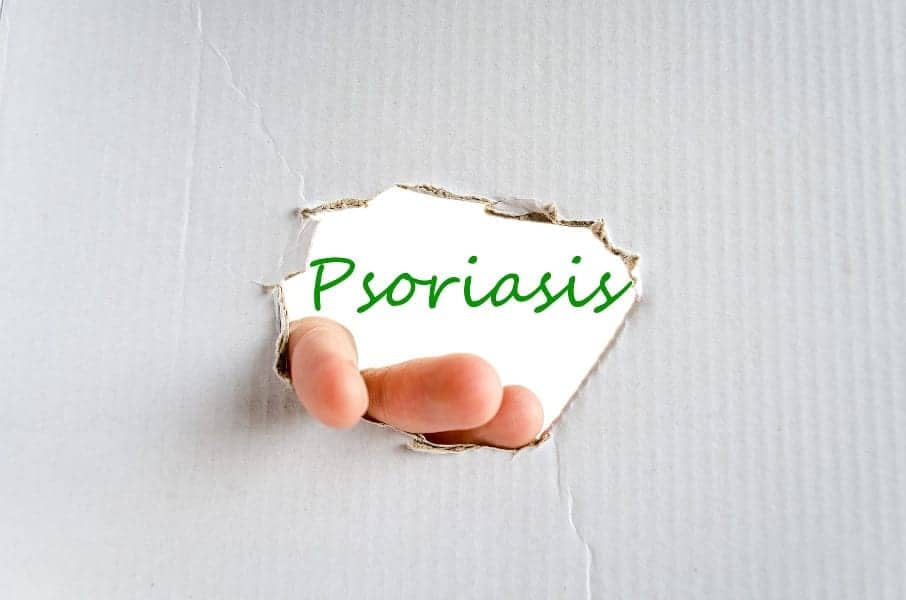PeakPASI Holds Utility for Assessment of Lifetime Highest PASI in Patients With Psoriasis