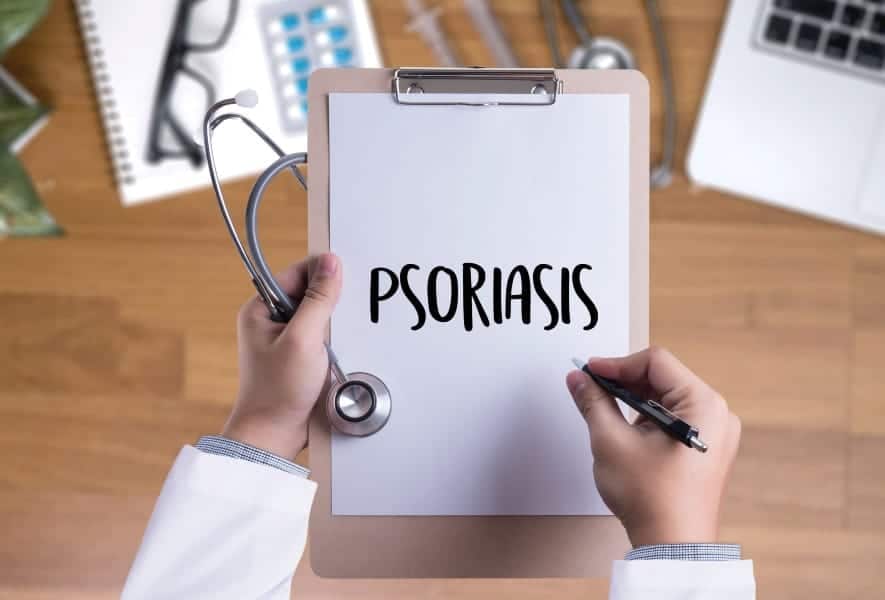 Psoriasis Successfully Treated with Topical Cannabinoids: Case Report