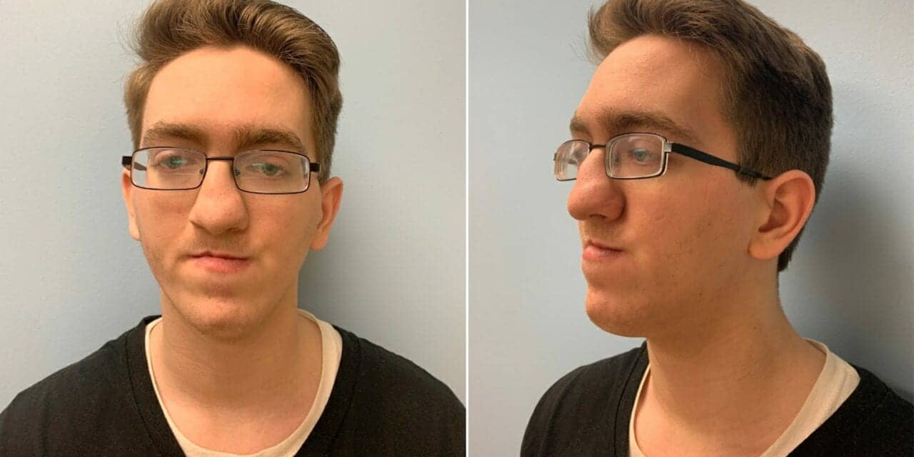 Valley Man Receives Life-Changing Facial Surgery