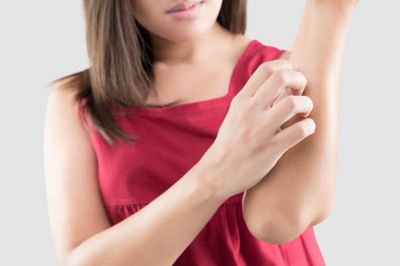 Study Ties Chronic Itch to Sleep Loss and Possible Signal of Increased Heart Disease Risk