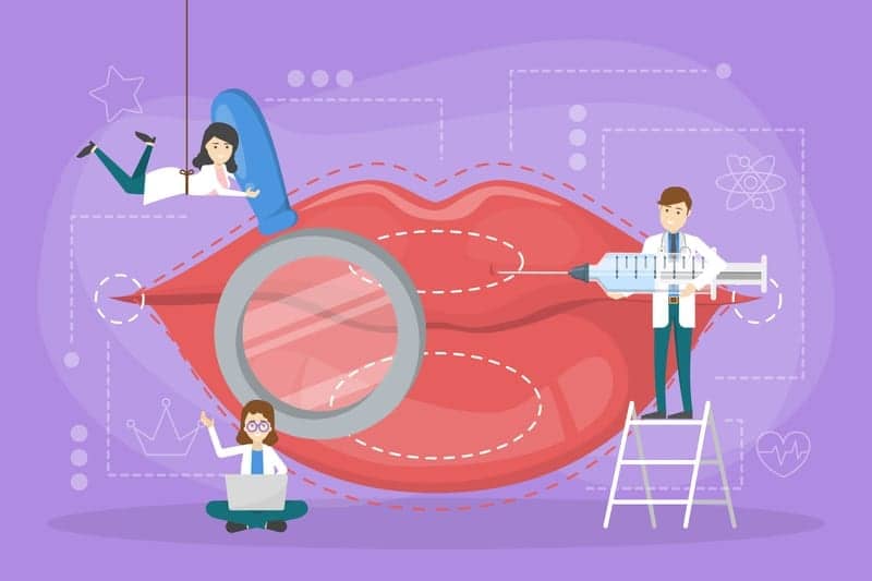 What Is a Permalip Implant?