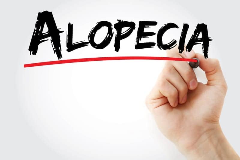 Risk Factors for Frontal Fibrosing Alopecia