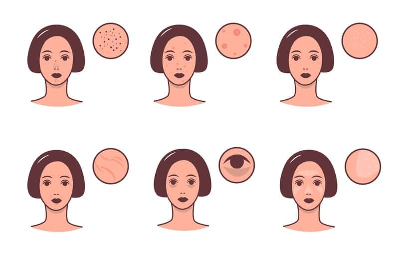 How to Identify and Treat Common Skin Problems