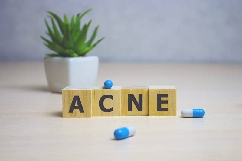 Acne Significantly Impacts Mental Health, Emphasizing Need for More Holistic Approaches to Treatment