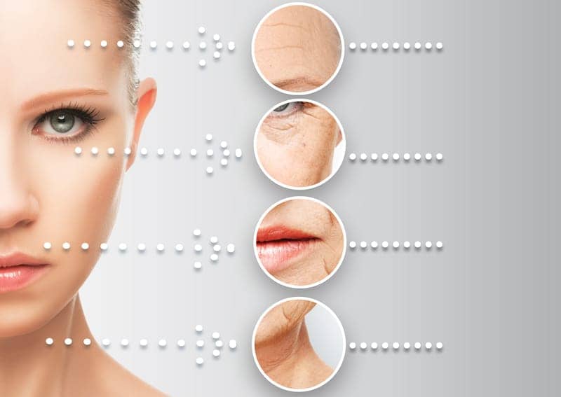 How Radiofrequency with Micro-needling Works