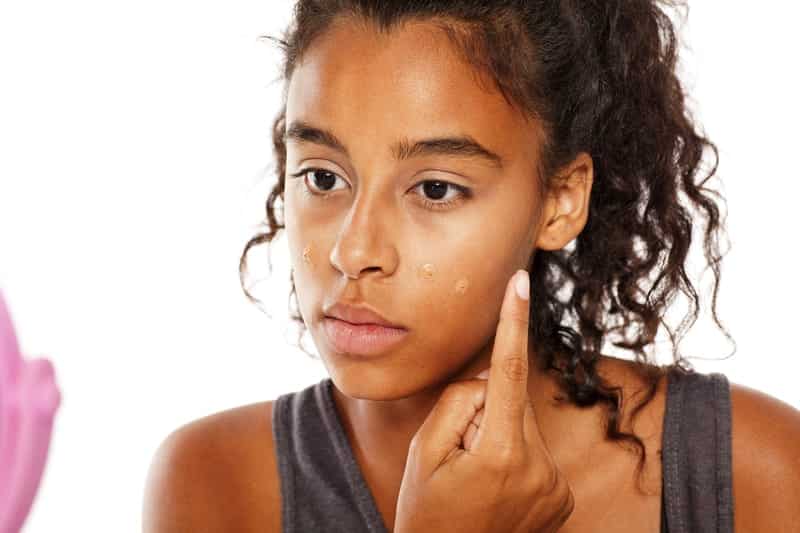 A Black Dermatologist Explains How To Clear Up Those Stubborn Dark Spots