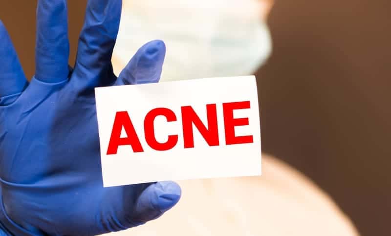 This Popular Acne Medication Carries a Disturbing Legacy