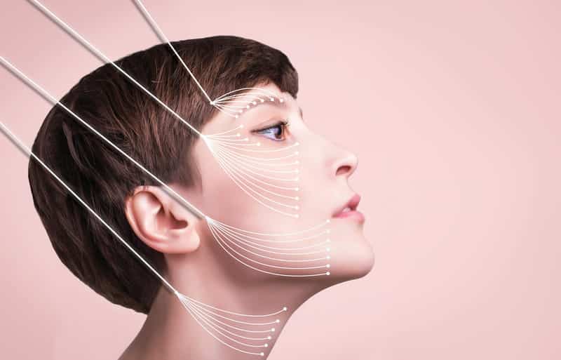 Thread Lifts Are the Hottest Thing in Plastic Surgery—But Are They Worth the Hype?