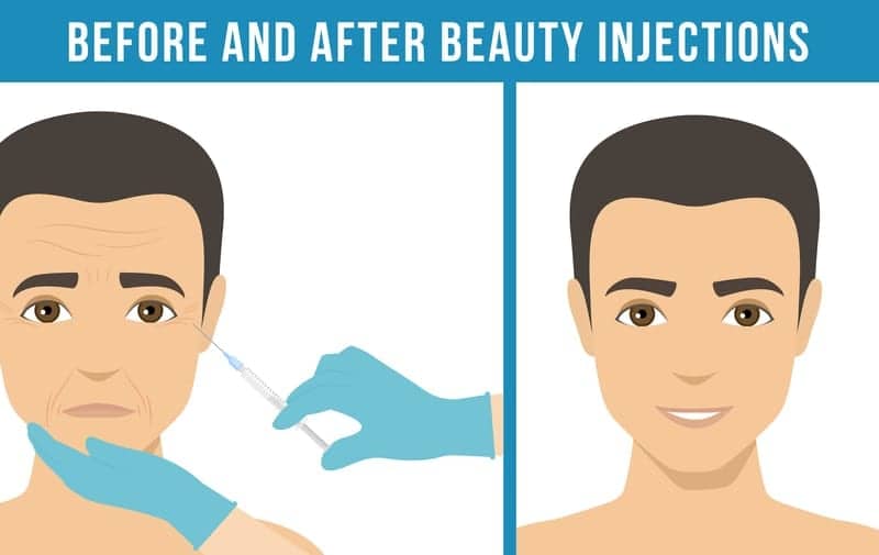 Why Men Are Starting To Get Fillers