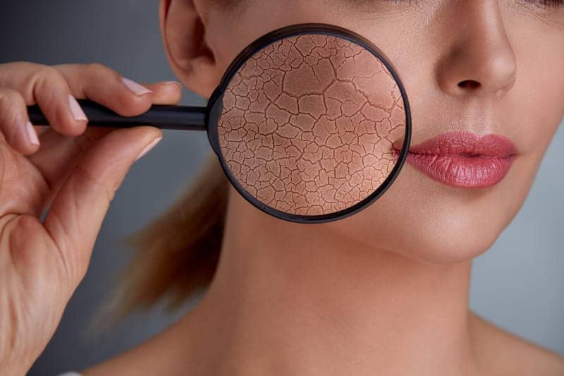Noninvasive TGF-β-Induced Therapy Improves Skin Appearance