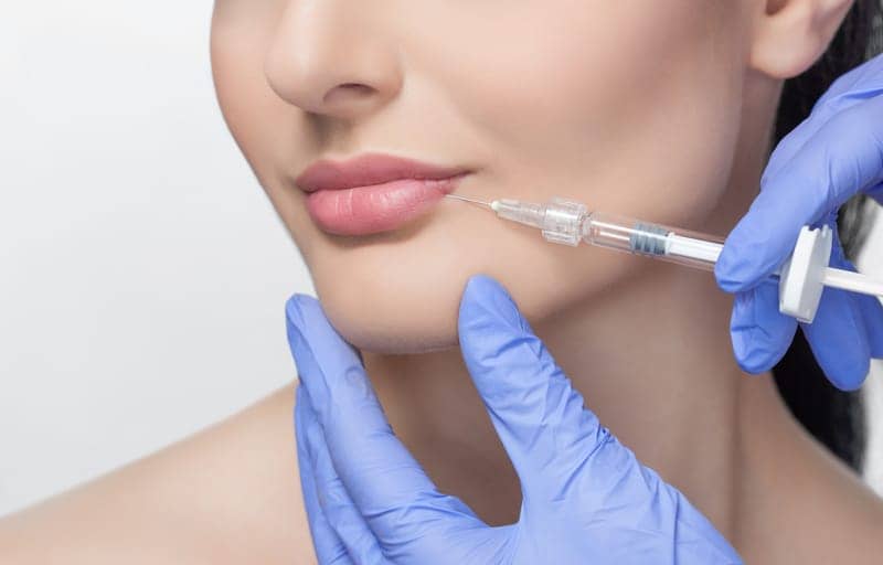 The No-Nonsense Guide To Lip Fillers, According To The Experts