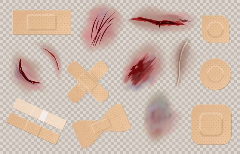 Dermatologists Break Down How to Heal Scars, Including Old Ones