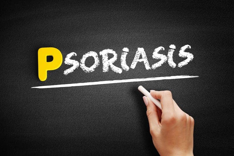 This Is How Psoriasis Appears On Black Skin, And How It Can Be Diagnosed And Treated