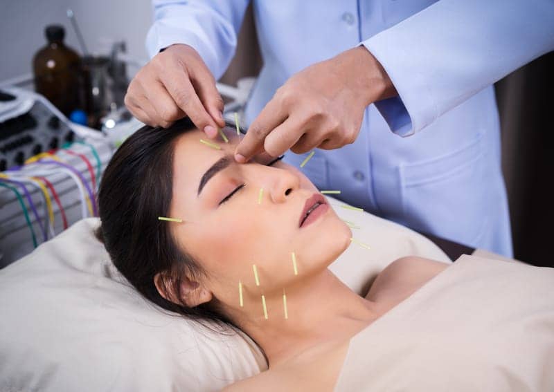 Going Under the Needle: Is Cosmetic Acupuncture the New Botox?