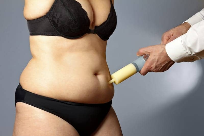 Why It Can Take Up to Six Months to be Bikini-Ready After Liposuction